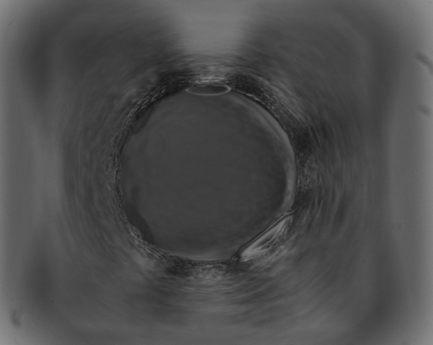 X0000091941441200710031109