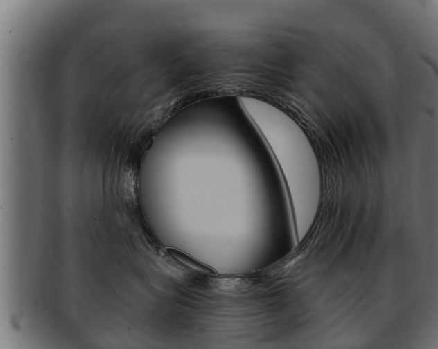 X0000091960575200709061103