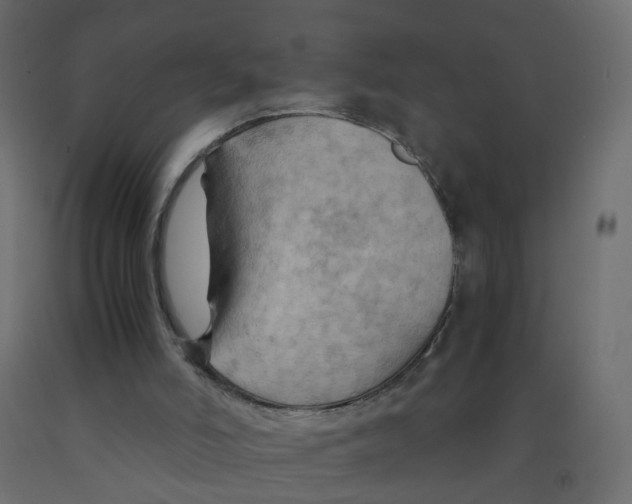 X0000091960006200710041038