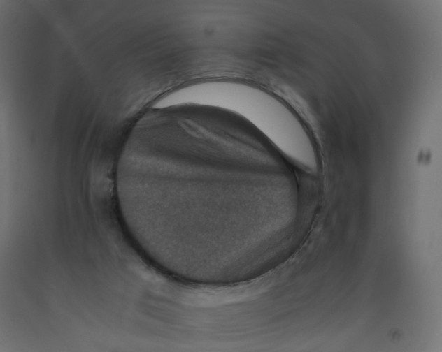 X0000091960017200710041038