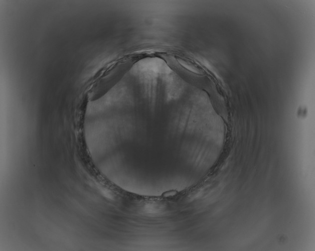 X0000091961399200710041019
