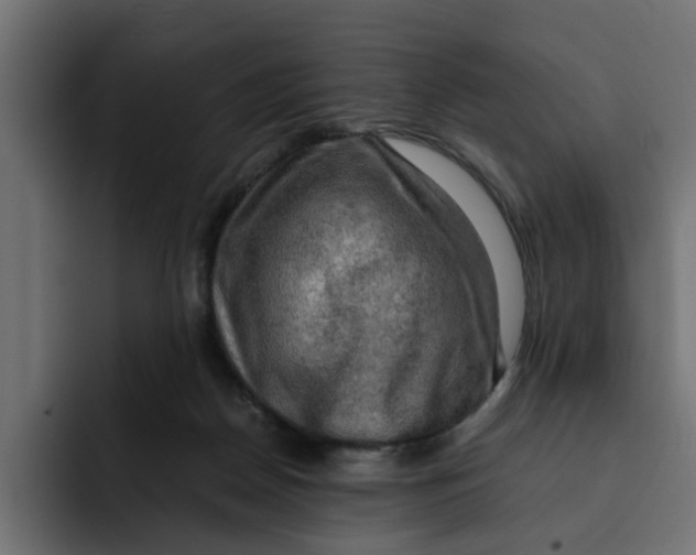 X0000092000170200710041014