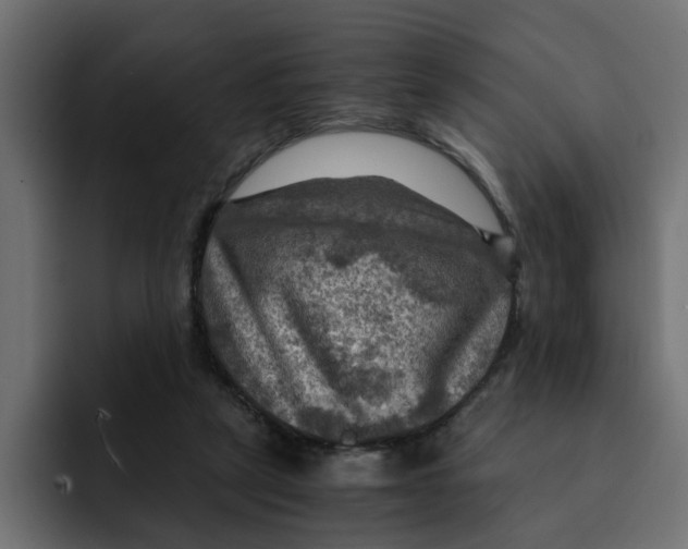 X0000092000257200710041013