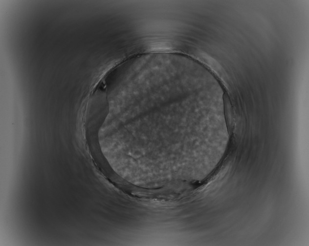 X0000092000385200710041011