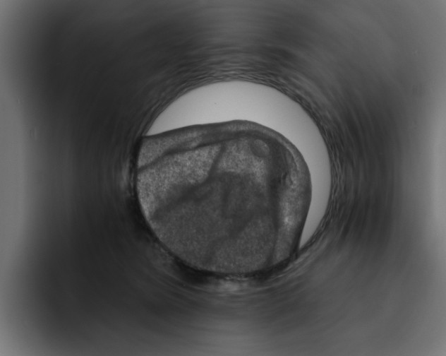 X0000092000420200710041011