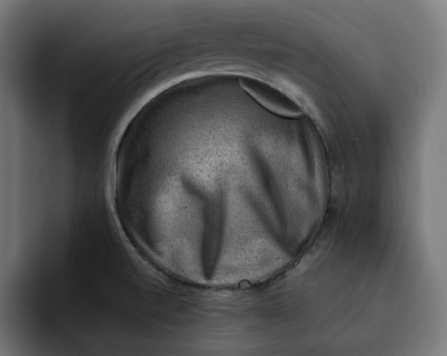 X0000092001520200710040958