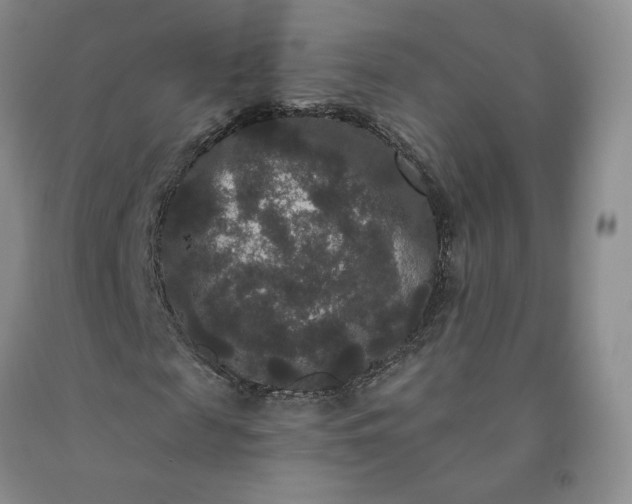 X0000092010817200709201528