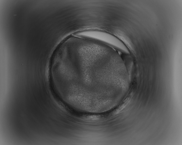 X0000092040156200710031031