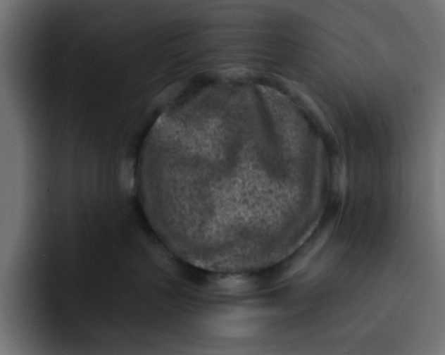 X0000092040383200710031029