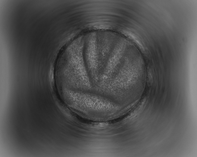 X0000092040398200710031028