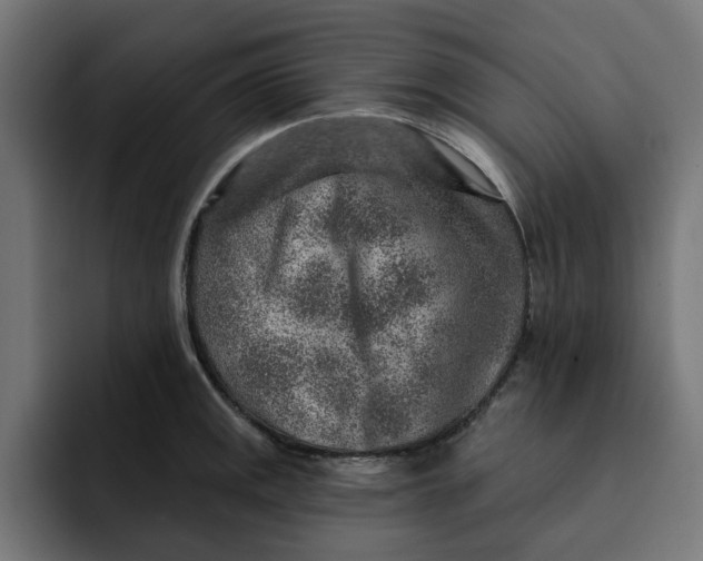 X0000092041141200710031020