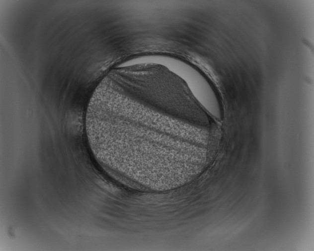 X0000092040017200710101006