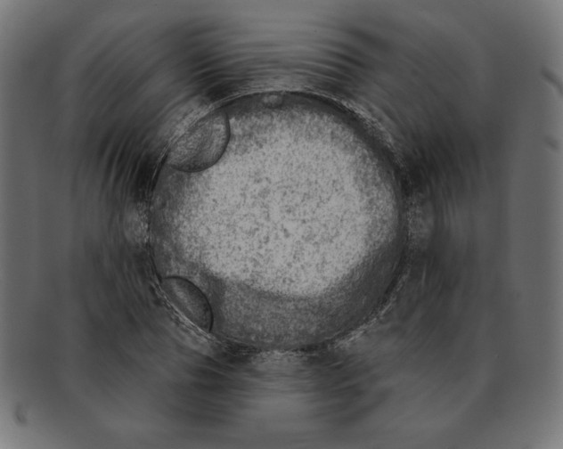 X0000092040929200710100955