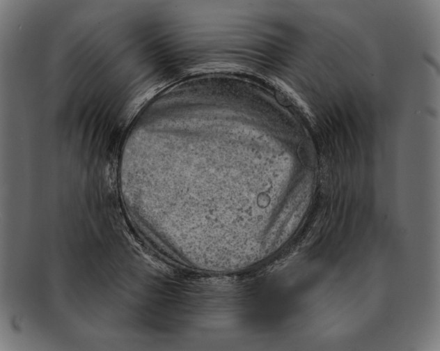 X0000092040937200710100955