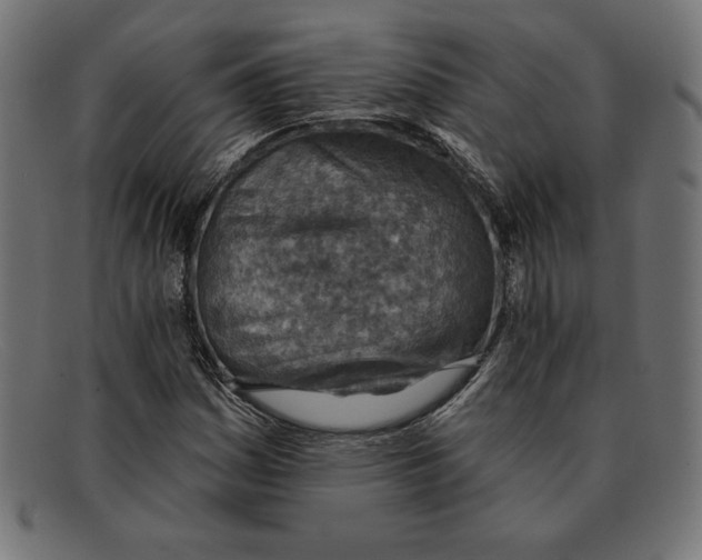 X0000092041161200710100952