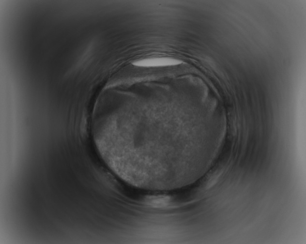 X0000092050266200710031048