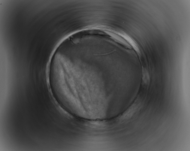 X0000092051102200710031038