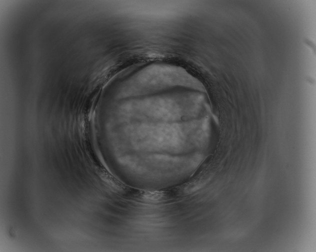 X0000092050720200710101015