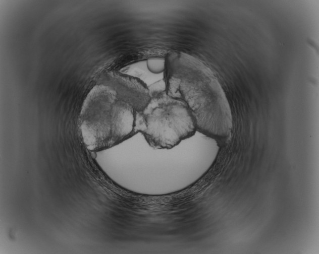 X0000092050737200710101015