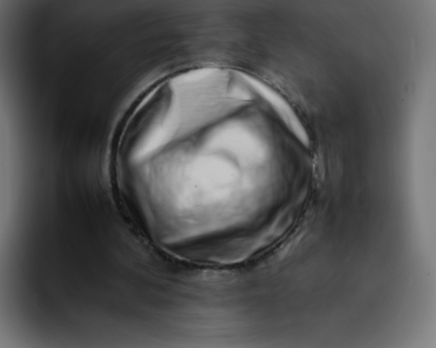 X0000092060292200710031105