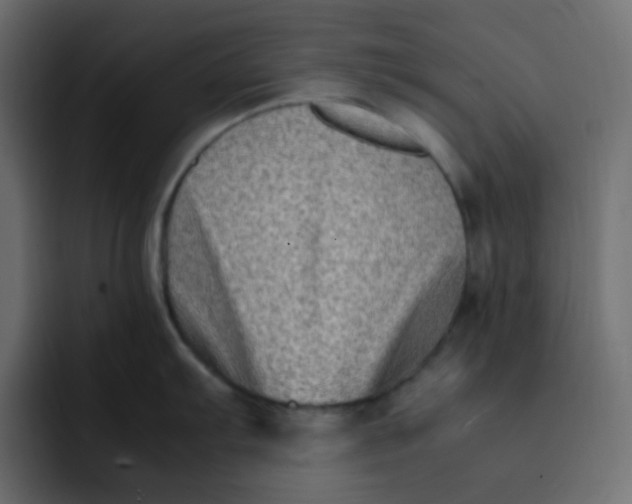 X0000092061103200710031056