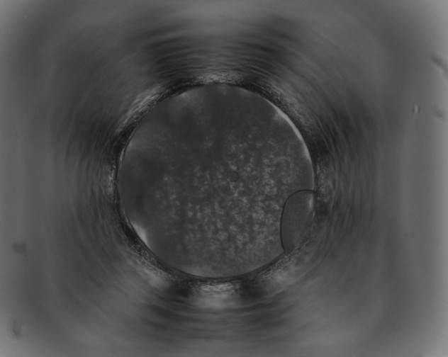 X0000092060357200710101038