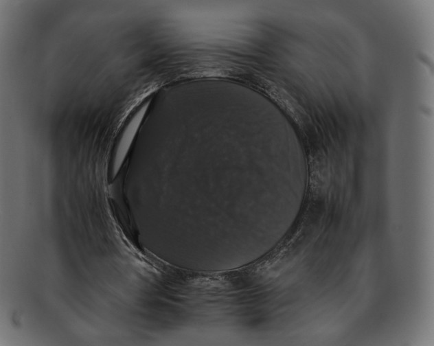 X0000092060386200710101038