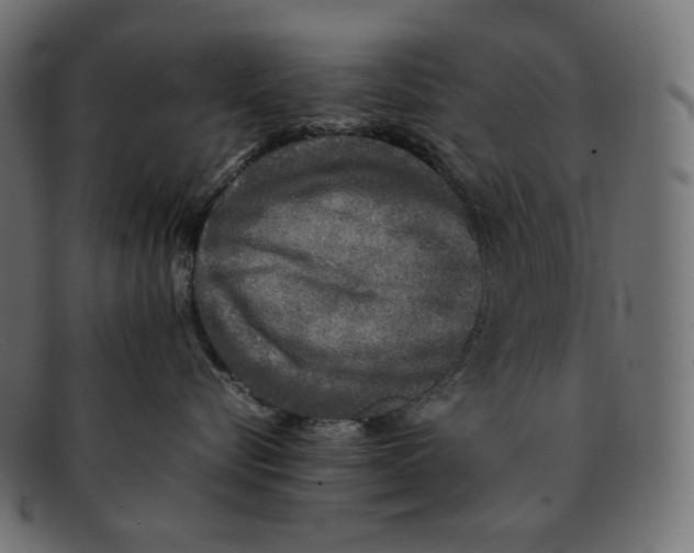 X0000092060576200710101036