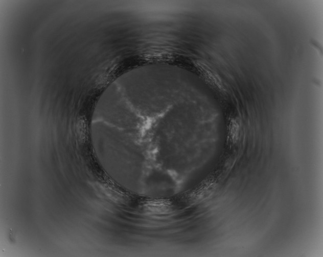 X0000092060659200710101035