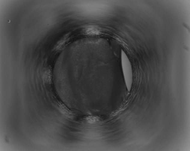 X0000092060762200710101034