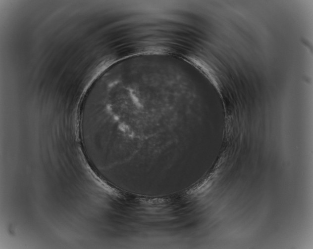 X0000092060851200710101032