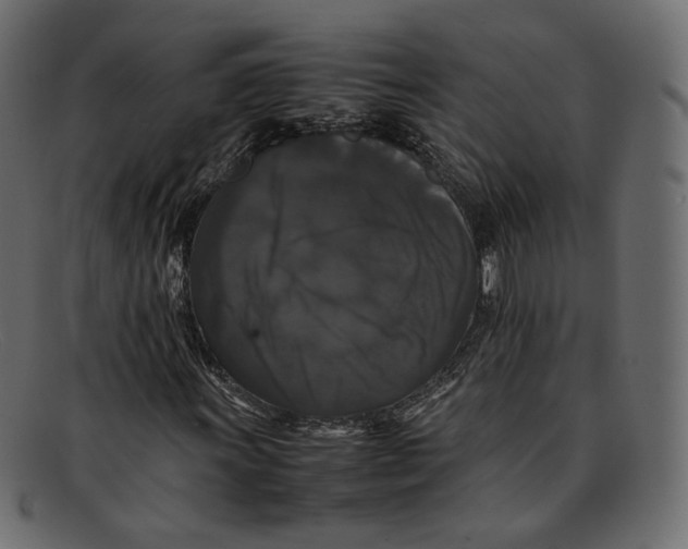 X0000092061011200710101030