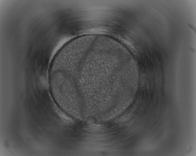 X0000092061470200710101025