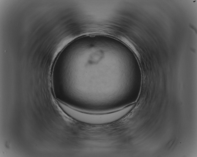 X0000092061485200710101025