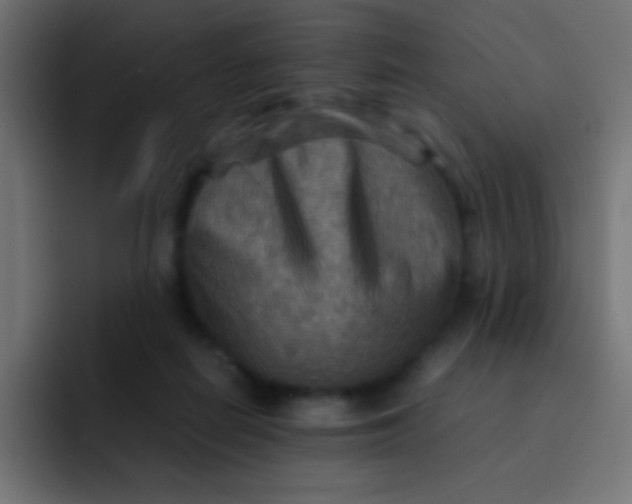 X0000092070266200710031124