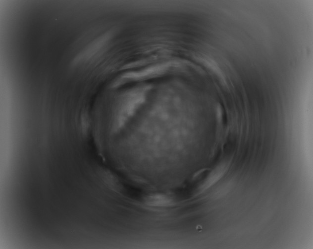 X0000092070285200710031124