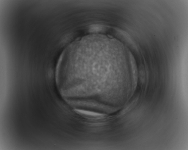 X0000092070375200710031123