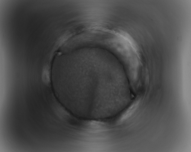 X0000092070393200710031122