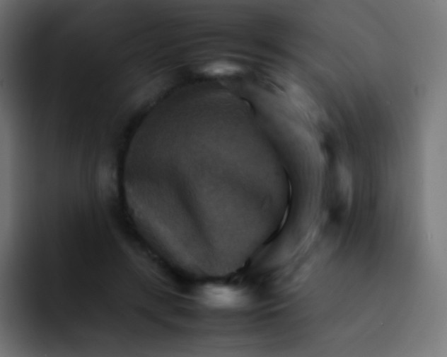 X0000092070547200710031120