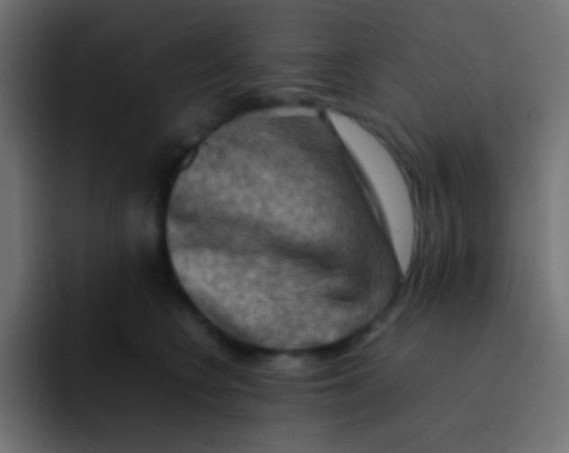 X0000092070566200710031120