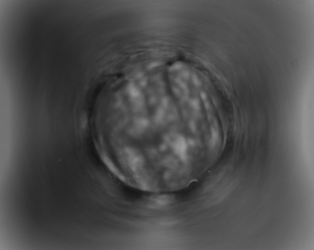 X0000092070711200710031118