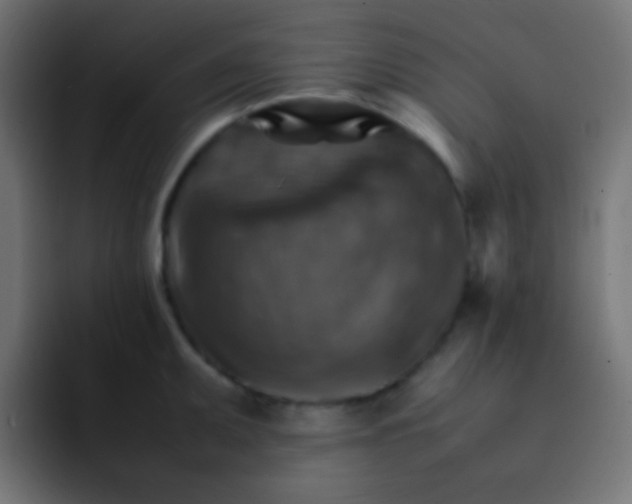 X0000092071095200710031114