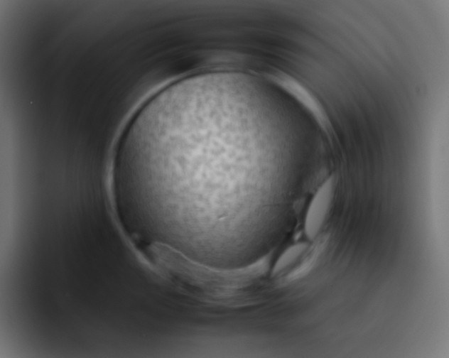 X0000092071149200710031114