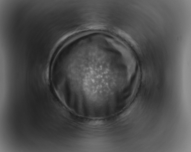 X0000092071174200710031113