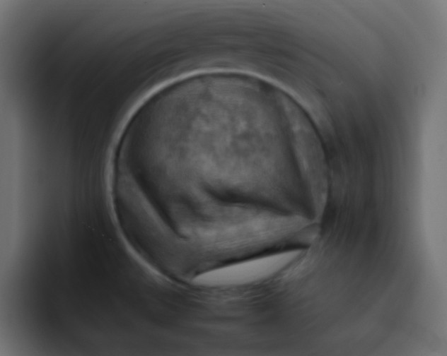X0000092071527200710031109