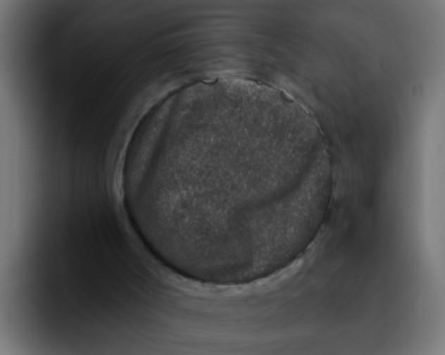 X0000092080002200710031145