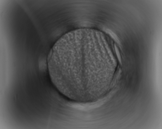 X0000092080017200710031144