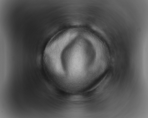 X0000092080066200710031144