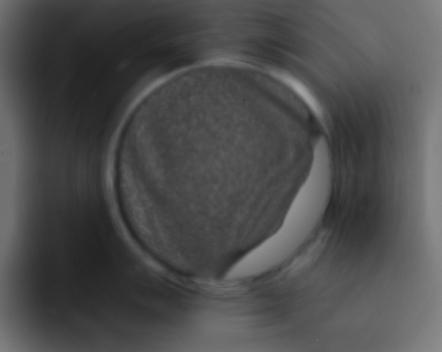 X0000092081007200710031133