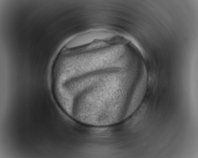 X0000092081143200710031132